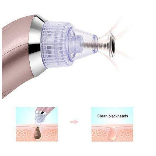 Derma Suction Blackhead Remover Acne And Pore Cleanser