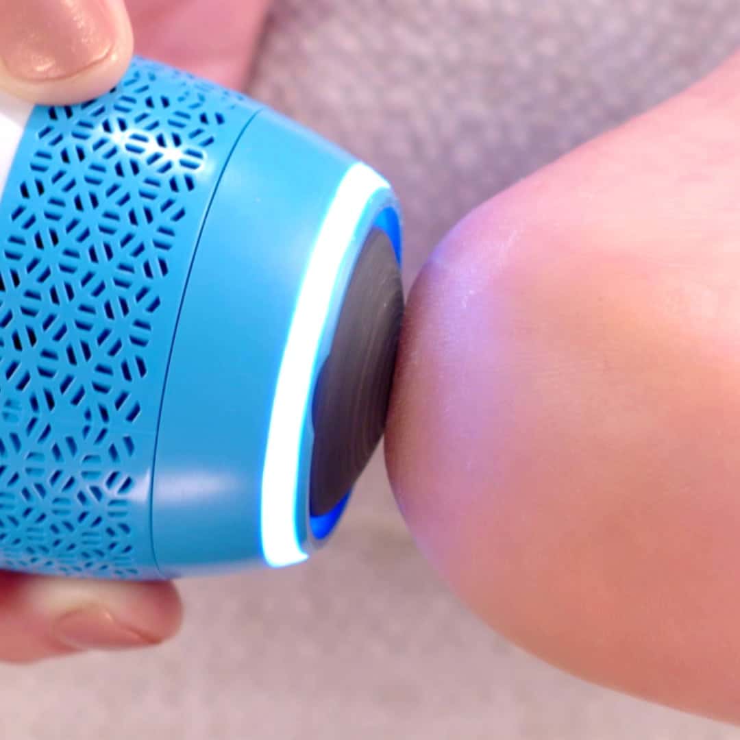 PediVac Electric Callus Remover with Vacuum - Foot Callus Remover