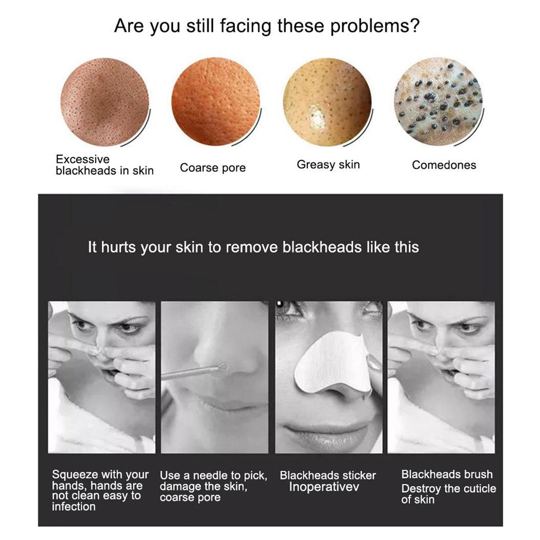 Derma Suction Blackhead Remover Acne And Pore Cleanser