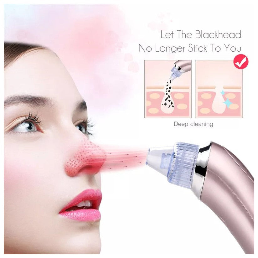 Derma Suction Blackhead Remover Acne And Pore Cleanser