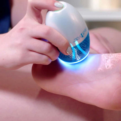 PediVac Electric Callus Remover with Vacuum - Foot Callus Remover